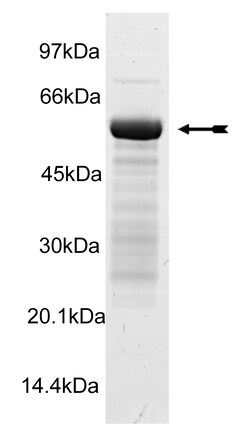 Eurofins DiscoverX PhK 2 Protein, Active 10 &mu;g | Buy Online | Eurofins DiscoverX | Fisher Scientific